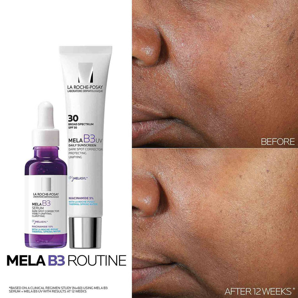 mela-b3-dark-spot-serum-and-mela-b3-uv-daily-moisturizer-with-spf-30-d9 3-Mela-B3-routine_1500X1500.jpg 3-Mela-B3-routine_1500X1500_699afb5eaaaf.jpg