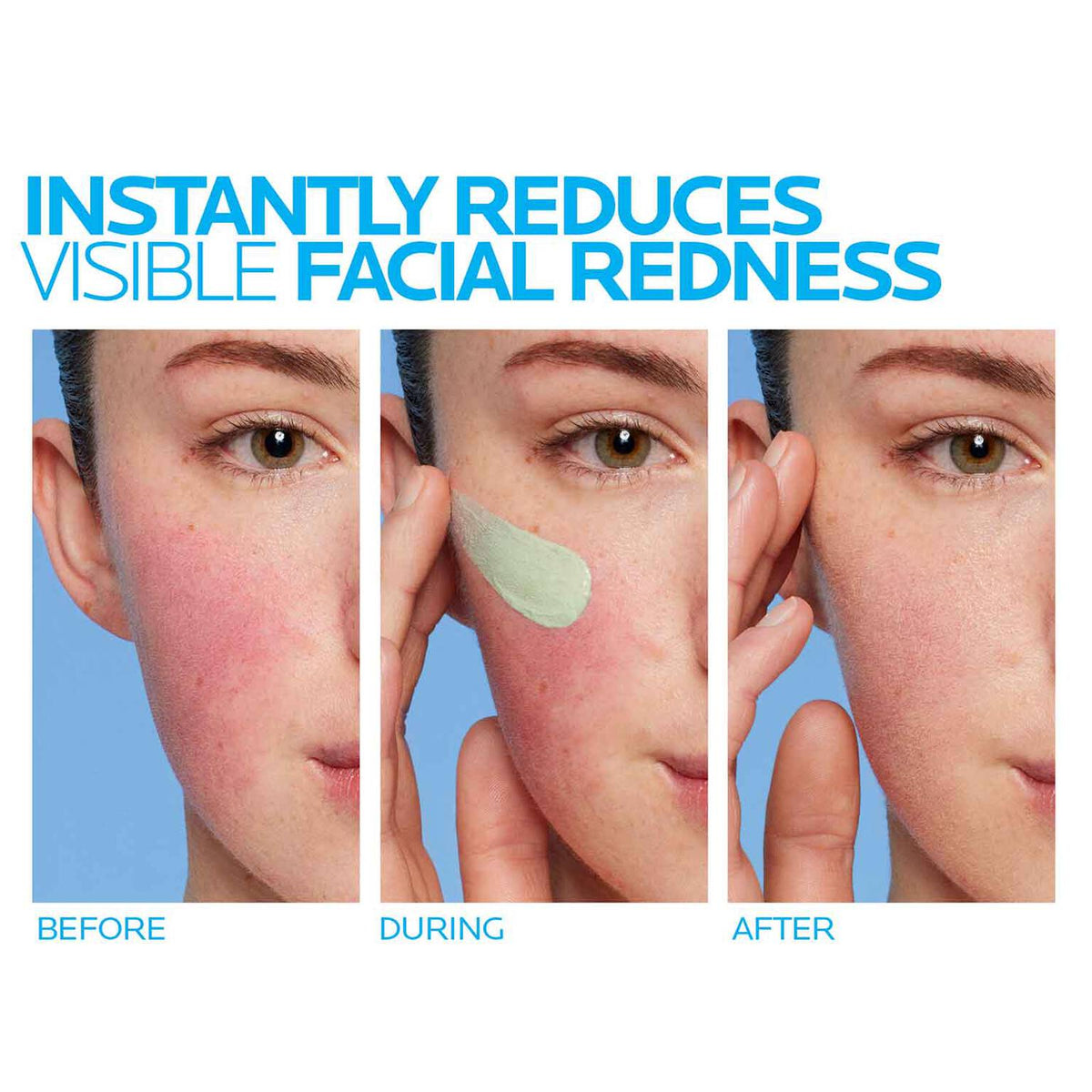 toleriane-rosaliac-ar-face-cream-for-visible-redness-m2 8_Toleriane_Rosaliac-AR-before-after.jpg 8_Toleriane_Rosaliac-AR-before-after_52d4967404aa.jpg