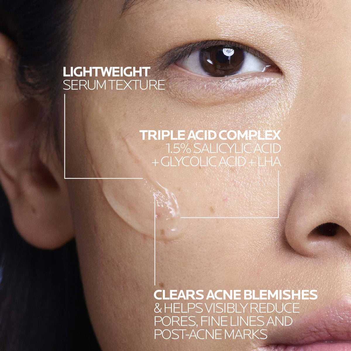 effaclar-salicylic-acid-acne-treatment-serum-l1 LaRochePosay-Product-Effaclar-Effaclar-Serum-30ml-3337875722827-Texture-REV.jpg LaRochePosay-Product-Effaclar-Effaclar-Serum-30ml-3337875722827-Texture-REV_243050550f1c.jpg