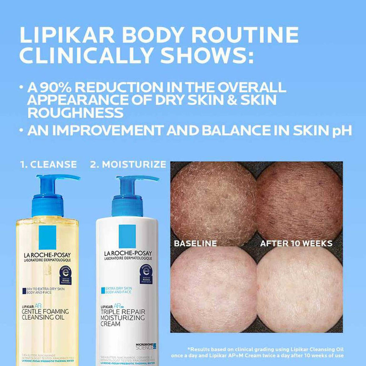 lipikar-ap-gentle-foaming-cleansing-oil-i7 Lipikar-clinical-study-banner_1500x1500.jpg Lipikar-clinical-study-banner_1500x1500_aca631b528b1.jpg
