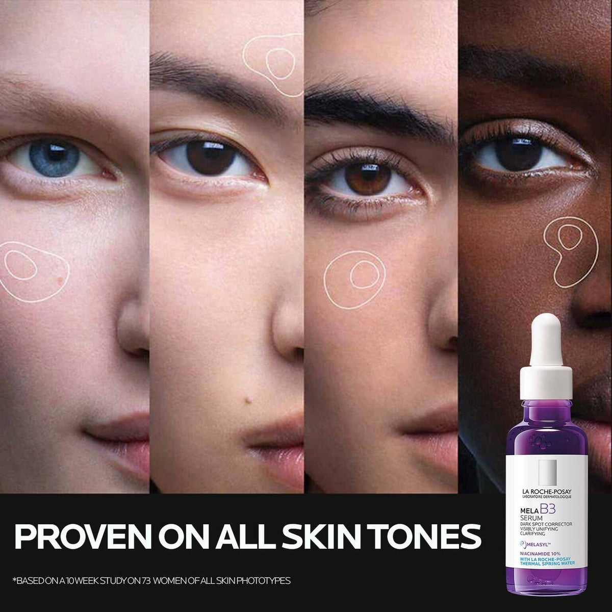 mela-b3-dark-spot-serum-with-melasyltm-niacinamide-e2 Mela-B3-SuitableFor-1500x1500.jpg Mela-B3-SuitableFor-1500x1500_a2d4a8a37f86.jpg