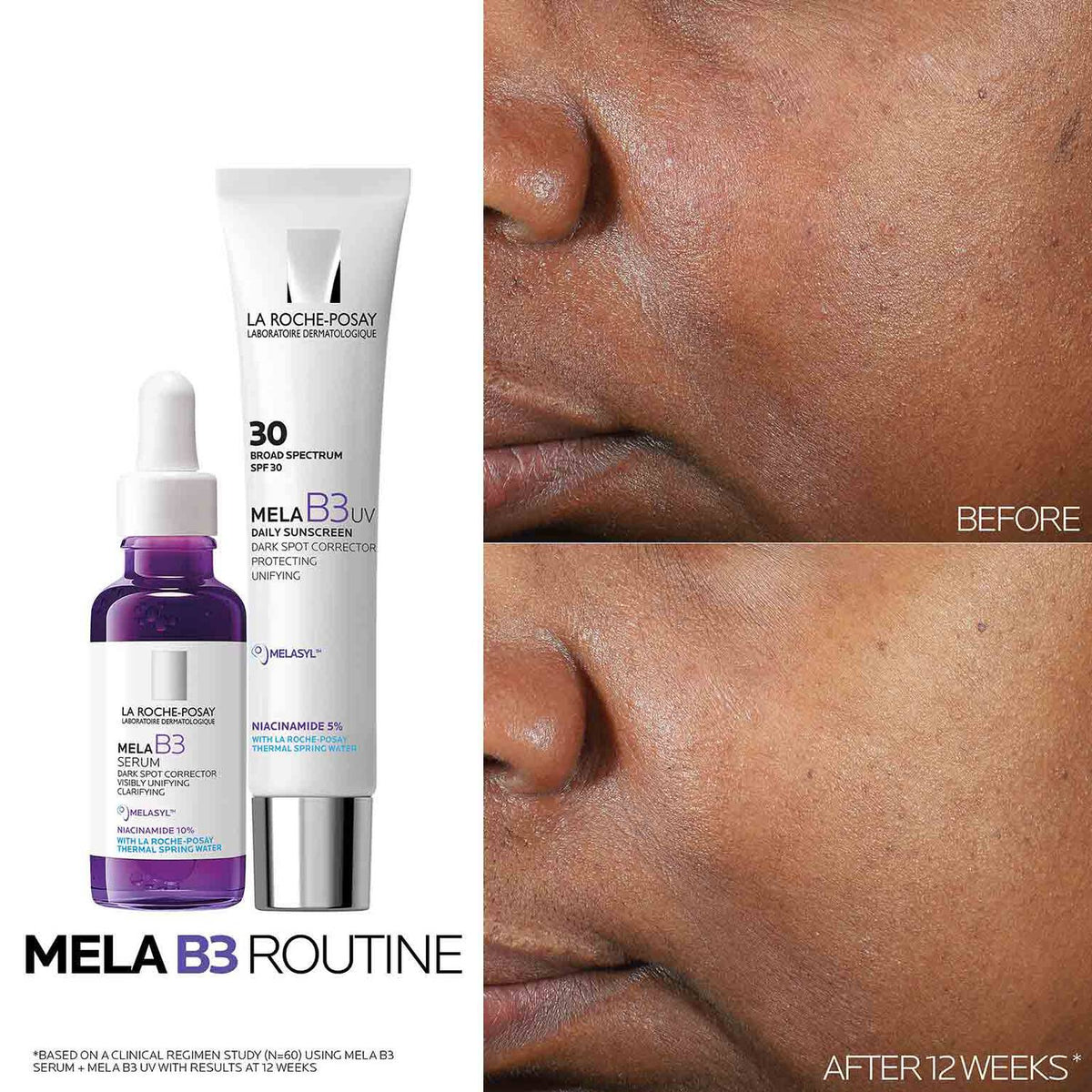 mela-b3-dark-spot-serum-with-melasyltm-niacinamide-e2 Mela-B3-routine_1500X1500.jpg Mela-B3-routine_1500X1500_4218e8d2a51a.jpg