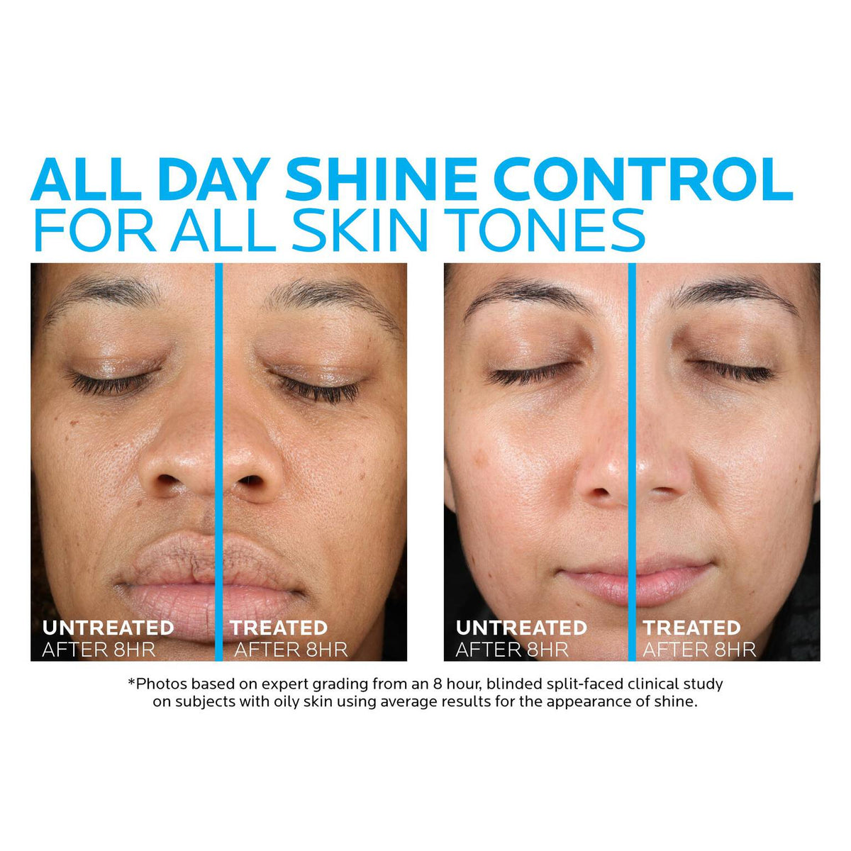 toleriane-double-repair-matte-face-moisturizer-for-oily-skin-j6 la-roche-posay-toleriane-matte-moisturizer-before-and-after-pdp-alt.jpg la-roche-posay-toleriane-matte-moisturizer-before-and-after-pdp-alt_29894fb3234d.jpg